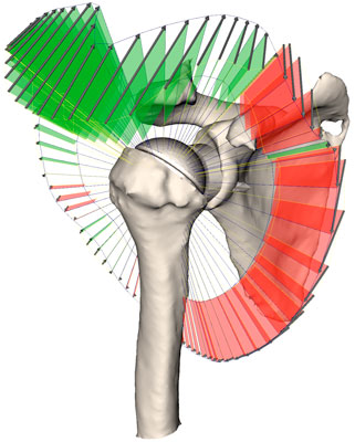 Slimme software voor bewegingsvrijheid